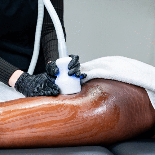 toning facials at bio/synergy in Bethesda, MD